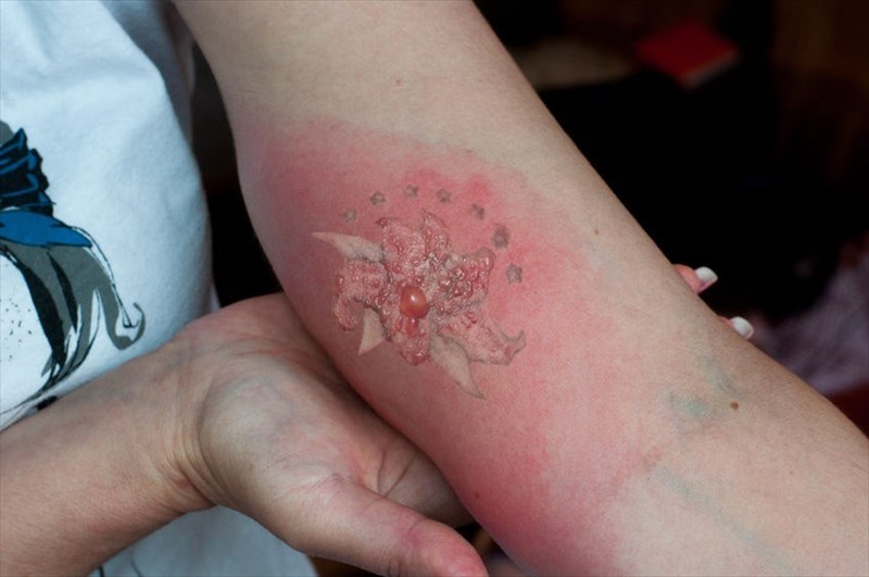 What Happens to Your Skin After a Tattoo?