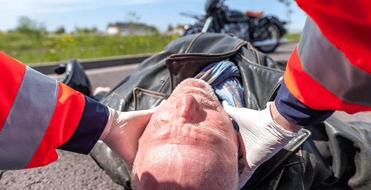 How to Avoid Traumatic Brain Injuries When Riding Your Motorbike