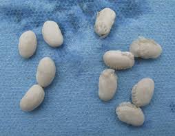 kidney bean like object in stool